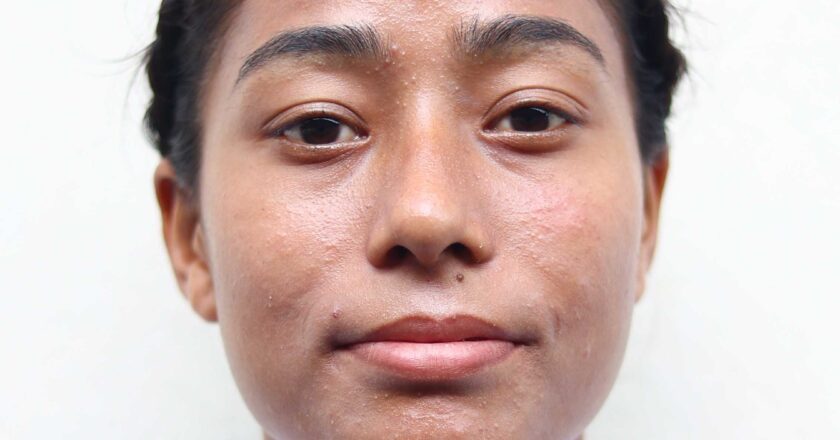 Pratiksha Thakuri